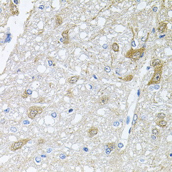 RAPSN Antibody in Immunohistochemistry (Paraffin) (IHC (P))