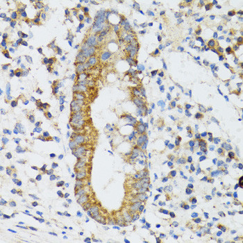 SRP19 Antibody in Immunohistochemistry (Paraffin) (IHC (P))