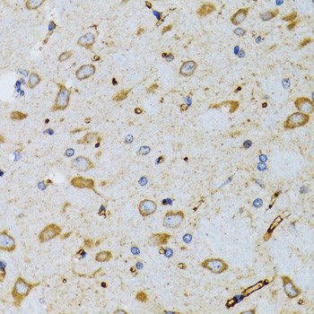 SRP19 Antibody in Immunohistochemistry (Paraffin) (IHC (P))