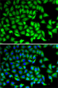 SUFU Antibody in Immunocytochemistry (ICC/IF)