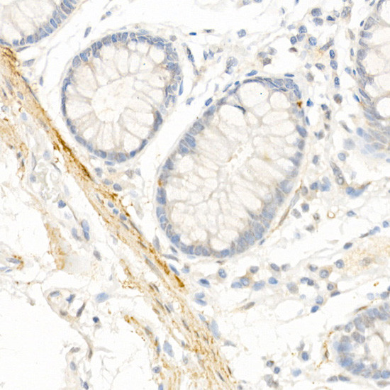 TAGLN Antibody in Immunohistochemistry (Paraffin) (IHC (P))