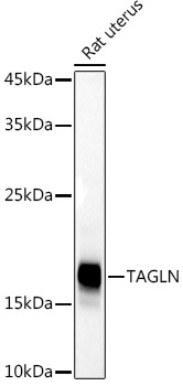 TAGLN Antibody in Western Blot (WB)