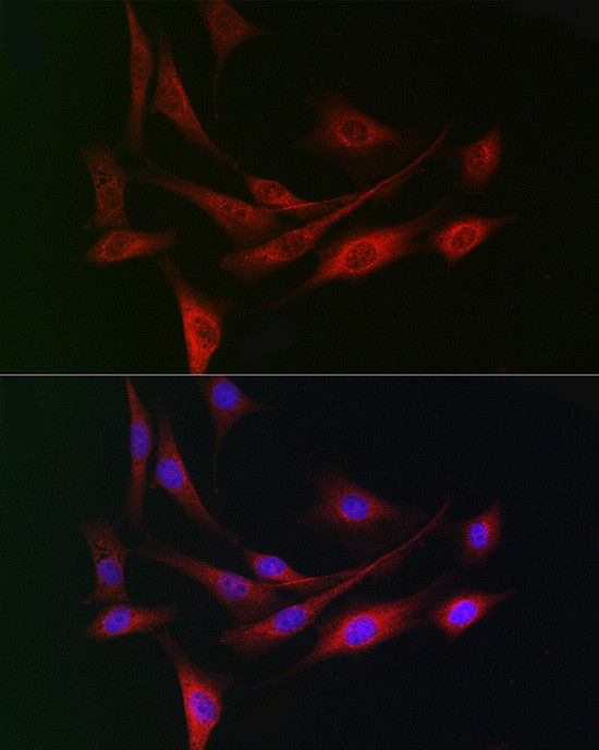 DCAF7 Antibody in Immunocytochemistry (ICC/IF)