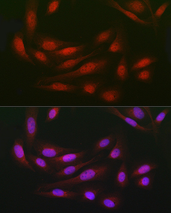 DCAF7 Antibody in Immunocytochemistry (ICC/IF)