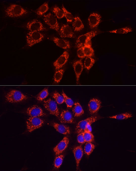 ACSL4 Antibody in Immunocytochemistry (ICC/IF)