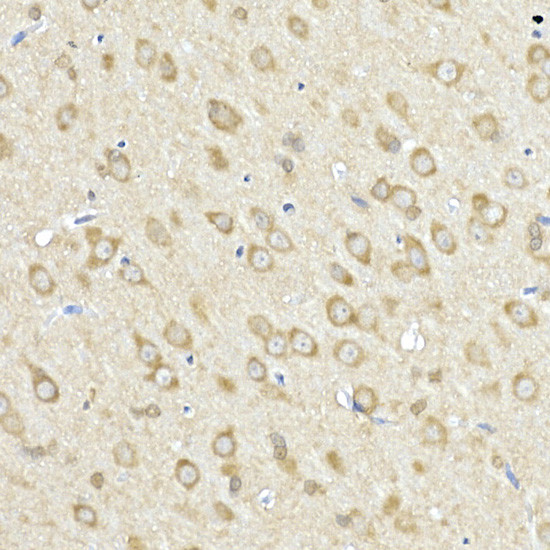 ACSL4 Antibody in Immunohistochemistry (Paraffin) (IHC (P))