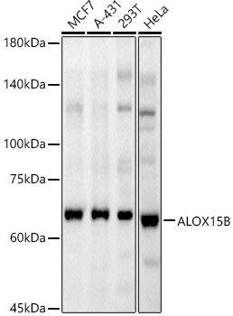 ALOX15B Antibody in Western Blot (WB)