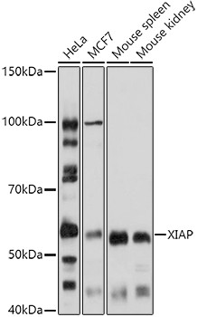 XIAP Antibody in Western Blot (WB)