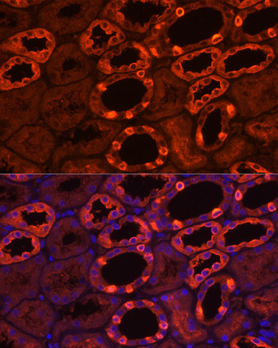 ATP6V1B1 Antibody in Immunohistochemistry (Paraffin) (IHC (P))