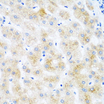 DHODH Antibody in Immunohistochemistry (Paraffin) (IHC (P))