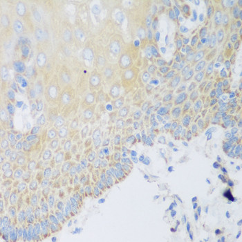 DHODH Antibody in Immunohistochemistry (Paraffin) (IHC (P))