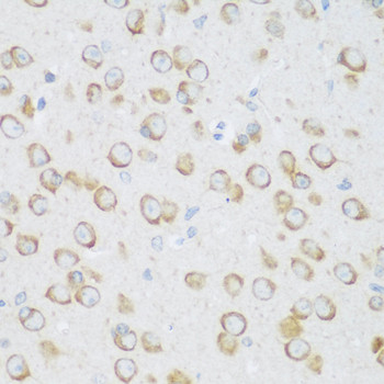 DHODH Antibody in Immunohistochemistry (Paraffin) (IHC (P))