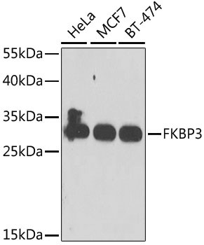 FKBP25 Antibody in Western Blot (WB)