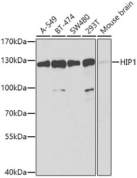 HIP1 Antibody in Western Blot (WB)