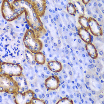 MYO1C Antibody in Immunohistochemistry (Paraffin) (IHC (P))