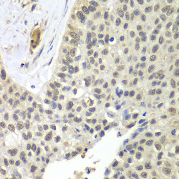 SNRPD2 Antibody in Immunohistochemistry (Paraffin) (IHC (P))