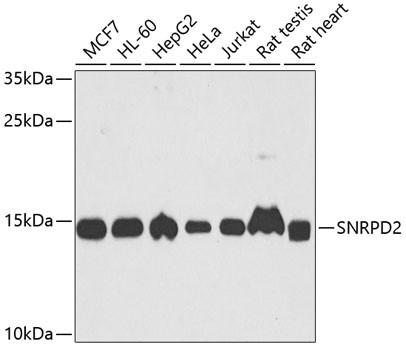 SNRPD2 Antibody in Western Blot (WB)