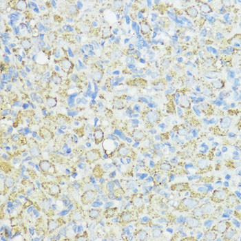 SOD3 Antibody in Immunohistochemistry (Paraffin) (IHC (P))