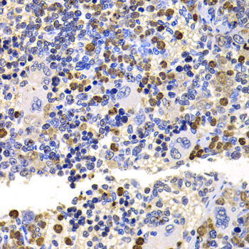 UBE2V2 Antibody in Immunohistochemistry (Paraffin) (IHC (P))