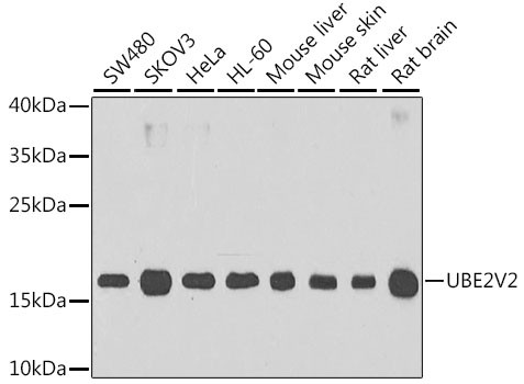 UBE2V2 Antibody in Western Blot (WB)