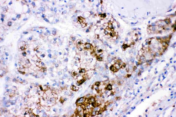 CBS Antibody in Immunohistochemistry (Paraffin) (IHC (P))