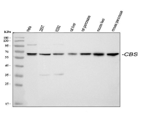 CBS Antibody in Western Blot (WB)