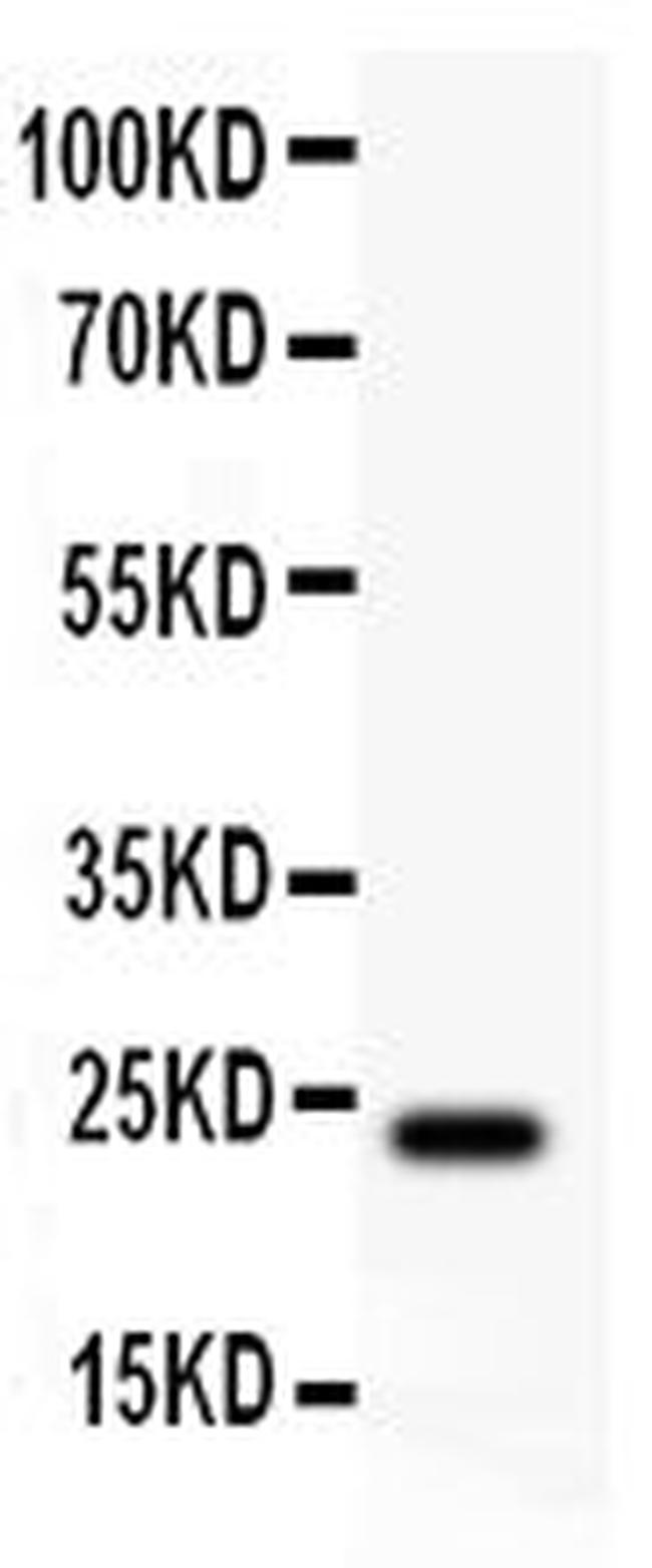 Claudin 5 Antibody in Western Blot (WB)