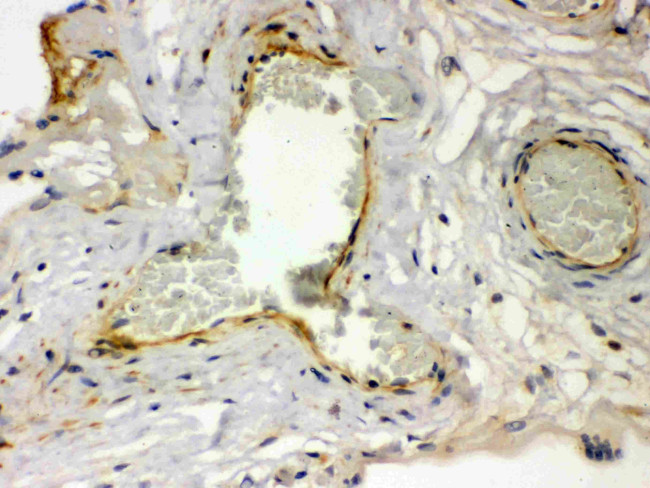 PAR1 Antibody in Immunohistochemistry (Paraffin) (IHC (P))