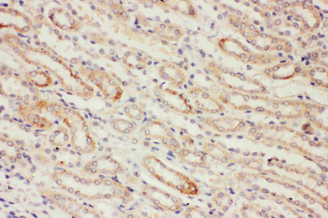 PP2A alpha Antibody in Immunohistochemistry (Paraffin) (IHC (P))