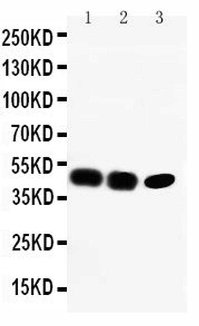 CCR6 Antibody in Western Blot (WB)