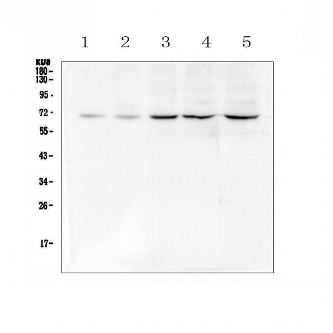 CHK2 Antibody in Western Blot (WB)