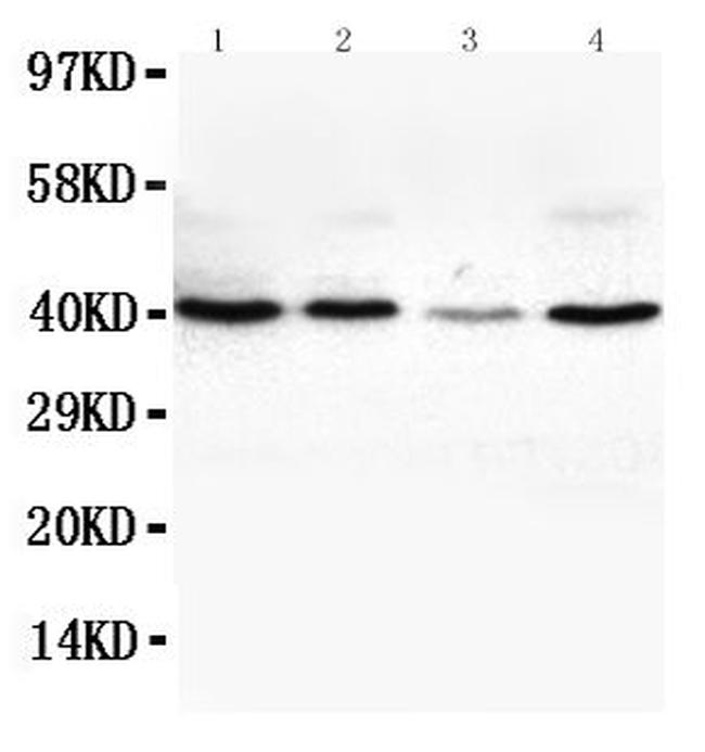 VEGFD Antibody in Western Blot (WB)