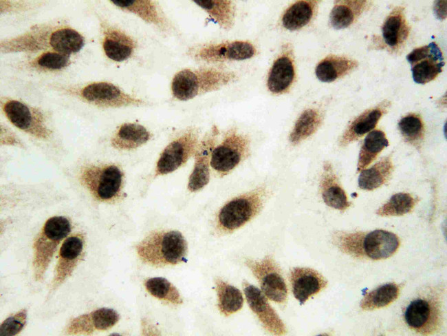 ERK1 Antibody in Immunocytochemistry (ICC/IF)