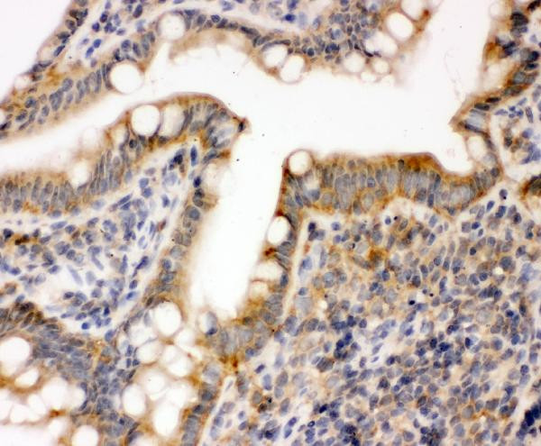 ERK1 Antibody in Immunohistochemistry (Paraffin) (IHC (P))