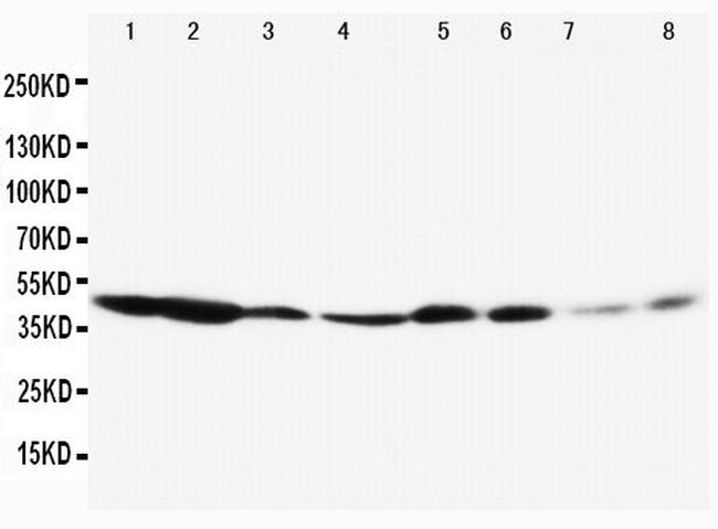 ERK1 Antibody in Western Blot (WB)