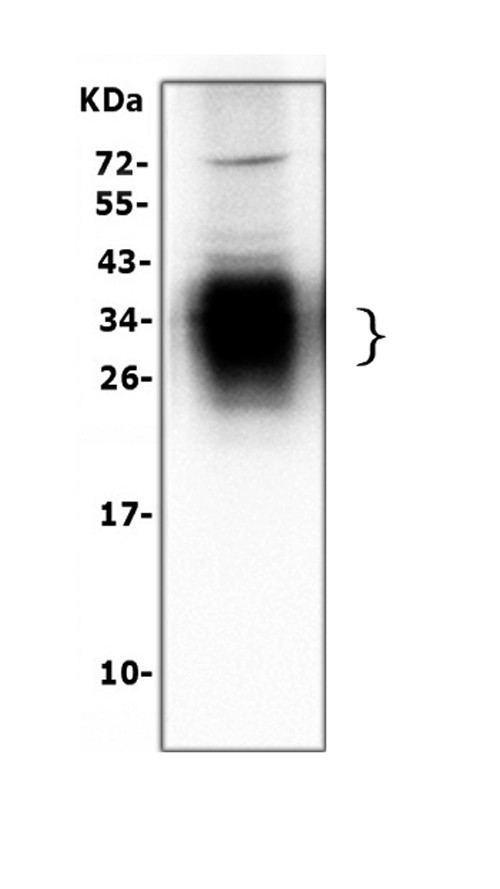 SFTPA1 Antibody in Western Blot (WB)