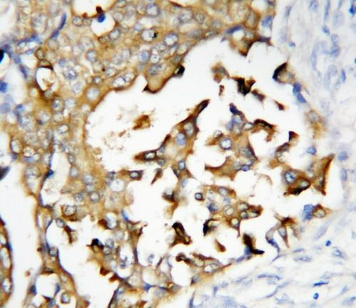 PSEN2 Antibody in Immunohistochemistry (Paraffin) (IHC (P))