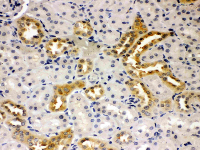 PSEN2 Antibody in Immunohistochemistry (Paraffin) (IHC (P))