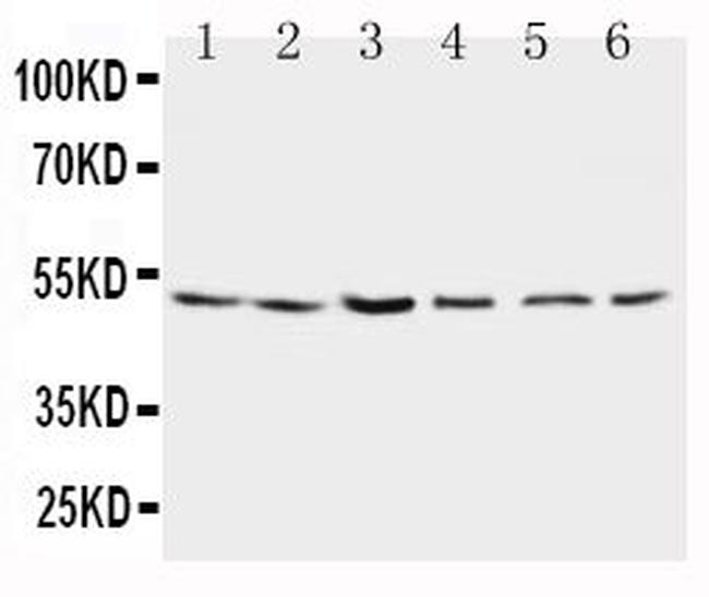 PSEN2 Antibody in Western Blot (WB)