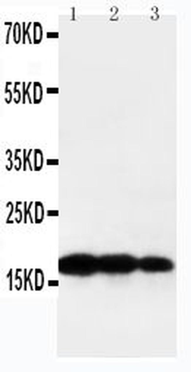 Human TNF beta Antibody in Western Blot (WB)