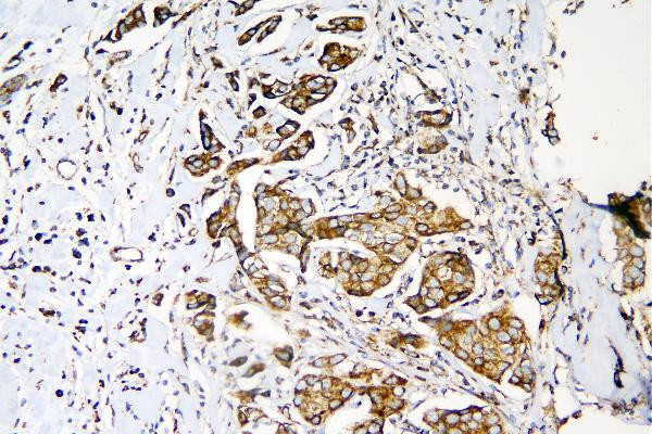 MEK3 Antibody in Immunohistochemistry (Paraffin) (IHC (P))