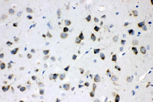 MEK3 Antibody in Immunohistochemistry (Paraffin) (IHC (P))