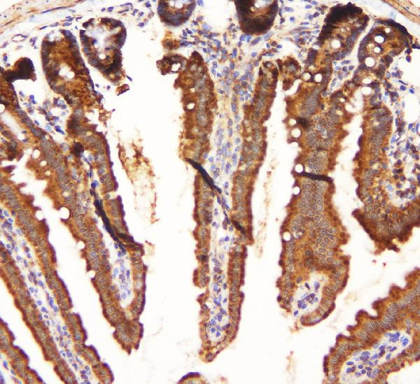 MEK3 Antibody in Immunohistochemistry (Paraffin) (IHC (P))