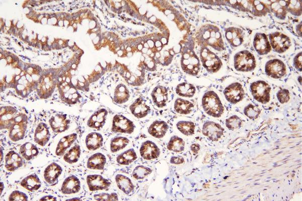 MEK3 Antibody in Immunohistochemistry (Paraffin) (IHC (P))