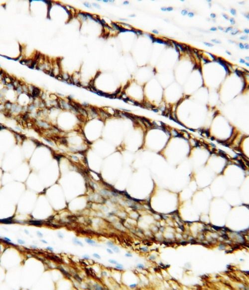 TIMP1 Antibody in Immunohistochemistry (Paraffin) (IHC (P))