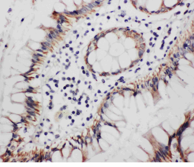 Progesterone Receptor Antibody in Immunohistochemistry (Paraffin) (IHC (P))