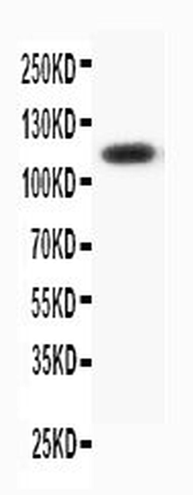 Progesterone Receptor Antibody in Western Blot (WB)