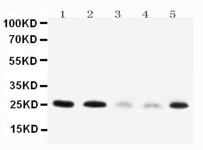 Pleiotrophin Antibody in Western Blot (WB)