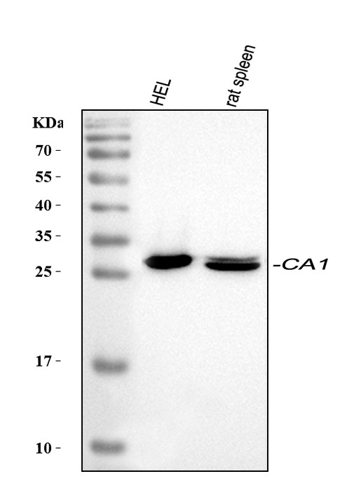 Carbonic Anhydrase I Antibody in Western Blot (WB)