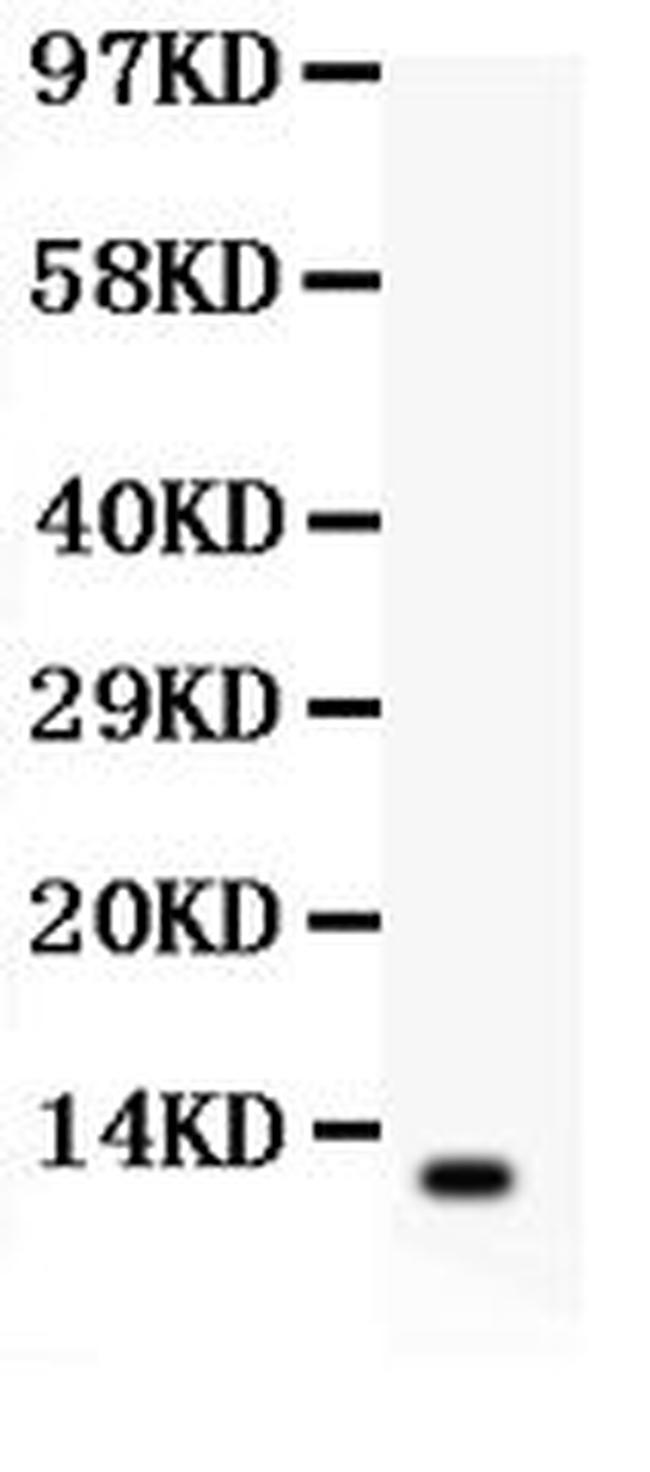 beta-Defensin 1 Antibody in Western Blot (WB)